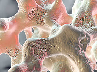 bone tissue